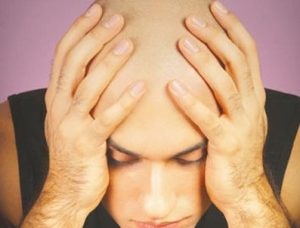 Erkeklerin Baş Düşmanı Kellik