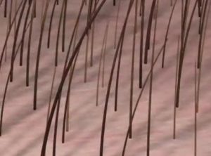 Saç Mezoterapisi Ve Sonrası