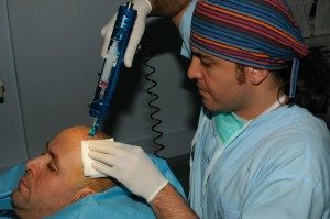 Saç Mezoterapisinin Diğer Yöntemlerden Farkı