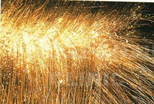 Erkek ve Kadınlarda Saç Dökülmesinin Nedenleri ve Tedavisi