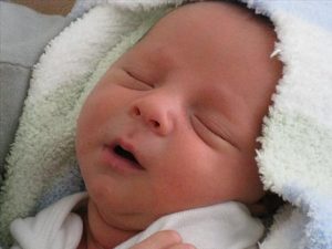 Yeni doğan bebeğin cilt rengi