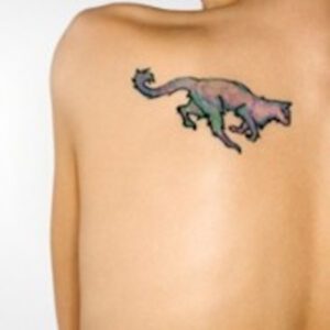 Lazerle Dövme Silme