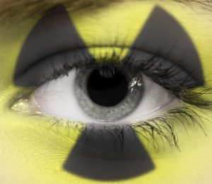 Radyasyon Hastalığı