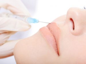 Dermal Dolgu Hakkında Bilmeniz Gerekenler