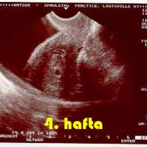 4.Hafta Hamilelik