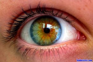 Sarı Nokta Hastalığı Nedir?