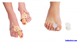 Ayak Başparmak Kemiği Çıkıntısı (Halluks Valgus) Nedir?