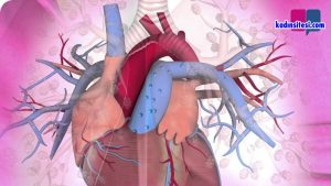 Pulmoner Emboli Ve Derin Ven Trombozu Nedir?