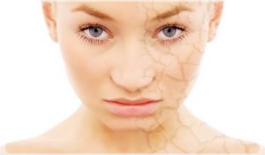 Kuru Ciltlere Bitkisel Çözüm