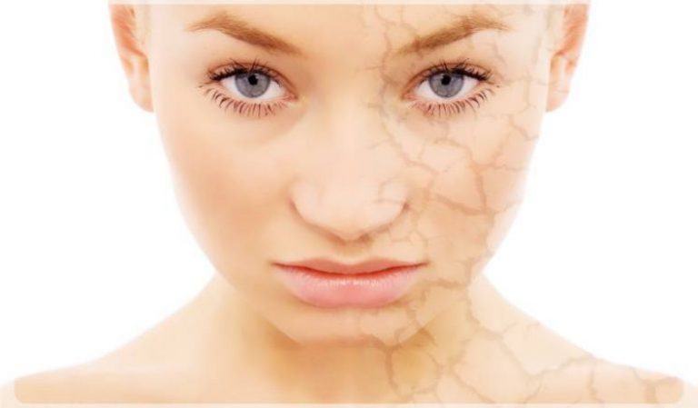 Kuru Ciltlere Bitkisel Çözüm