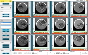 Embriyo Gelişiminin İzlenmesi
