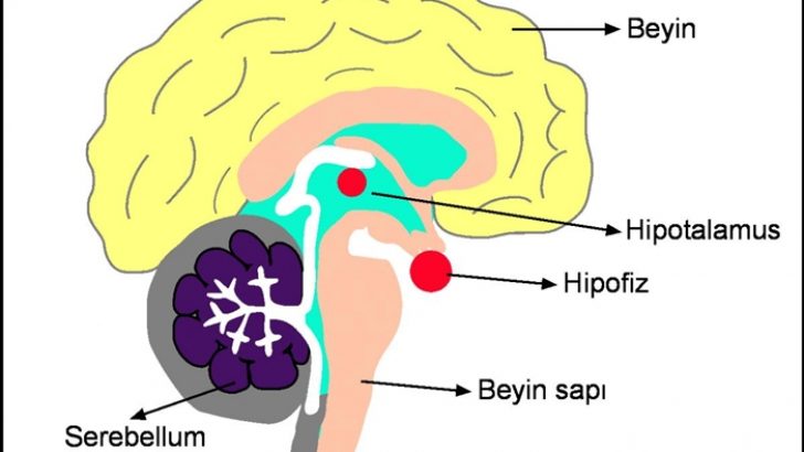 Hipofiz Bezi Tümörleri Nasıl Belirti Verir?