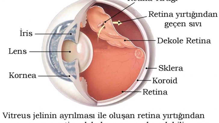 Retina Nedir?