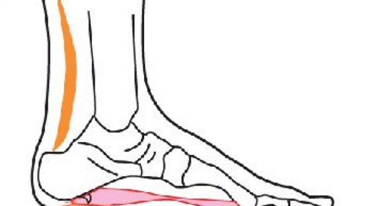 Topuk Dikeni Nedir?